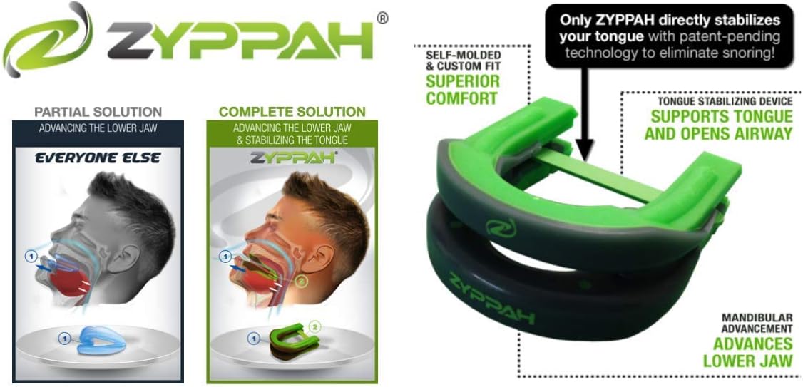 ZYPPAH Anti Snoring Hybrid Oral Appliance Mouthpiece Stop Snoring Sleep Aid Solution Snore Stopper Mouth Guard Device - Made in USA, FDA Cleared - Military